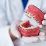 A orthodontist's gloved hands hold a mouth model with braces in San Antonio, TX